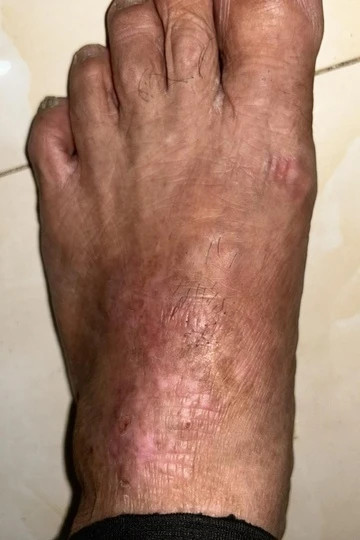 Chang trai ngua suot 4 nam vi mon an nguoi Viet khoai khau-Hinh-2