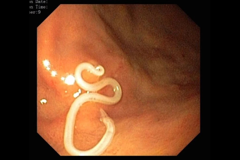 Chang trai ngua suot 4 nam vi mon an nguoi Viet khoai khau-Hinh-3