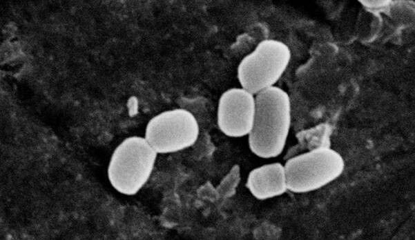 Soi kính hiển vi đội quân đất nung, những “bông hoa” màu trắng nở rộ - Hình 3 Soi kinh hien vi doi quan dat nung, nhung “bong hoa” mau trang no ro-Hinh-3