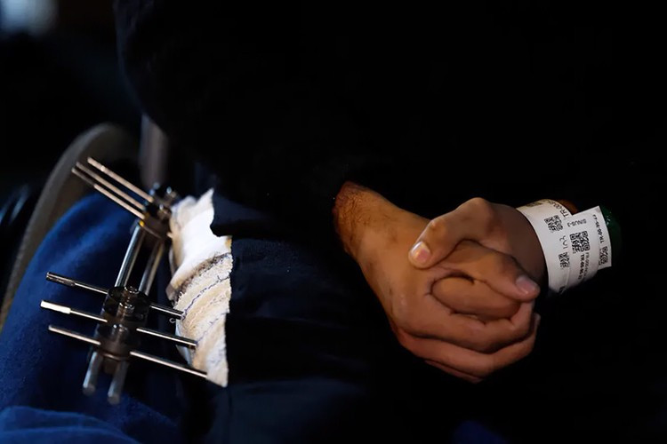 Tổ chức Y tế Thế giới cho biết, người Palestine đã phải vật lộn để được chăm sóc y tế tại nhà vì hàng chục nghìn người bị thương, hầu hết 36 bệnh viện không hoạt động hoặc quá tải. Ảnh: AFP.