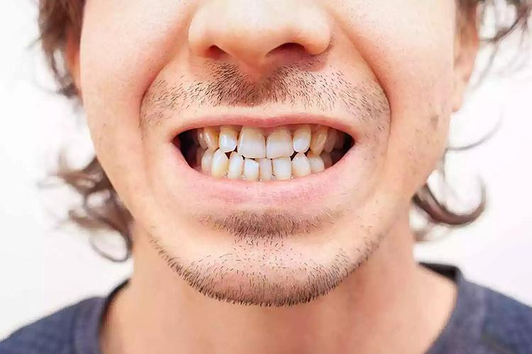 Vì sao răng người tiền sử lại thẳng và đều đến vậy? - Hình 2 Vi sao rang nguoi tien su lai thang va deu den vay?-Hinh-2