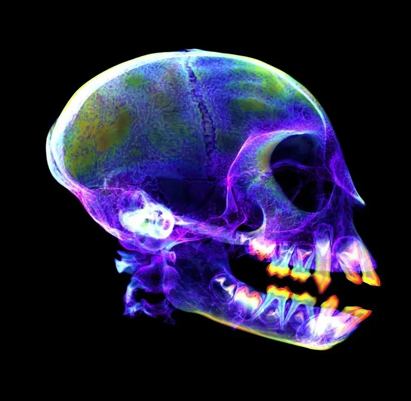 Hộp sọ của khỉ roloway: Hộp sọ của loài khỉ có nhiều nét tương đồng với hộp sọ người. Ảnh chụp trên cho thấy răng vĩnh viễn sắp mọc lên và thay thế răng sữa.