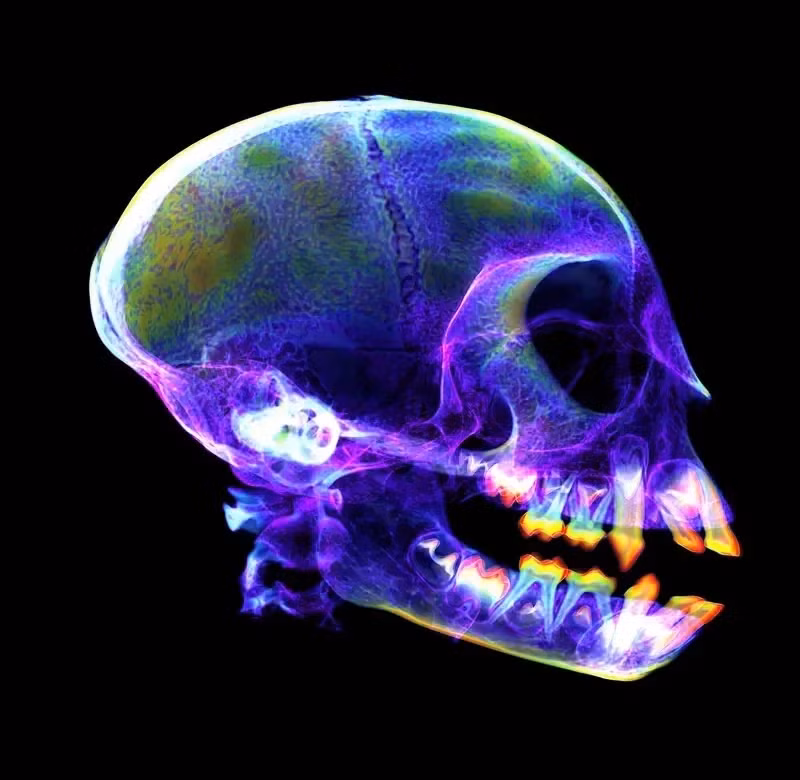 Hộp sọ của khỉ roloway: Hộp sọ của loài khỉ có nhiều nét tương đồng với hộp sọ người. Ảnh chụp trên cho thấy răng vĩnh viễn sắp mọc lên và thay thế răng sữa.