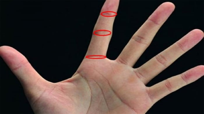 3. Ngón trỏ có tam ước vân: Thông thường giữa các đốt của ngón trỏ thường có một đường vân ngang gọi là Thực tiết vân. Nếu ai may mắn sở hữu cả ba đường vân ngang ở cả 3 đốt ngón tay thì gọi là Tam tước vân. Những người này khá may mắn, dễ nhận được sự giúp đỡ của người khác giới về mặt tiền bạc. Khi lấy chồng cũng sung túc, được chiều chuộng, đường tài vận lúc nào cũng rộng mở, con cháu sau này được hưởng phúc lây.