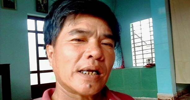 Thon chai ven pha Tam Giang thay doi, thoat mac “xom... ngai cuoi“-Hinh-2