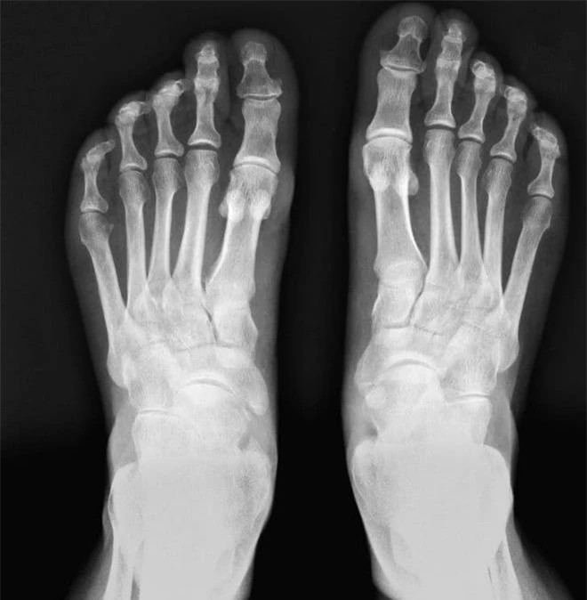 Con mat thu ba bien mat va hon 10 bi mat ve co the-Hinh-4