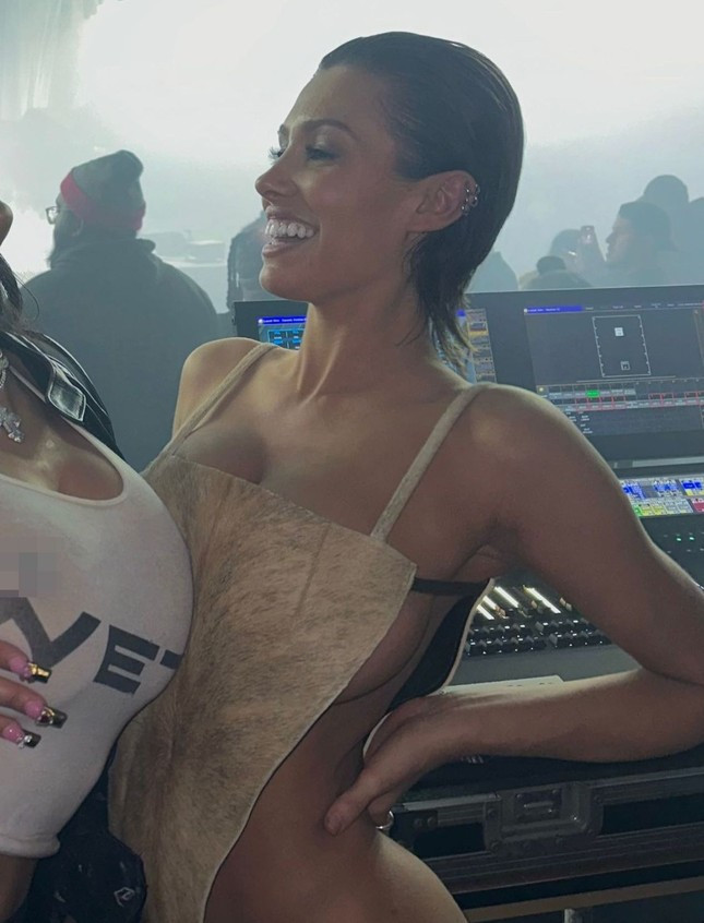 Guong mat Kanye West bien dang sau khi nho het rang-Hinh-3