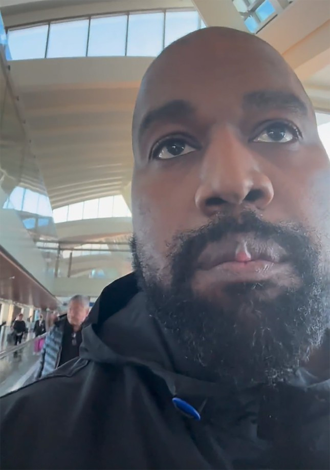 Guong mat Kanye West bien dang sau khi nho het rang