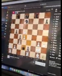 Lan dau tien nguoi duoc cay chip nao ti thi co voi may tinh