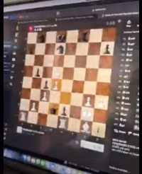 Lan dau tien nguoi duoc cay chip nao ti thi co voi may tinh