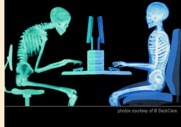  Thường xuyên ngồi không đúng tư thế khi làm việc bên máy vi tính. Đối với những người thường xuyên làm việc bên máy vi tính nhiều giờ liền thì đây là thói quen vô cùng nghiêm trọng. Nghiên cứu cho thấy rằng việc ngồi liên tục 8 giờ một ngày hoặc nhiều hơn có thể làm tăng nguy cơ bị bệnh cơ xương, tiểu đường, béo phì và các rối loạn khác. Bạn nên đặt màn hình máy tính dưới 5 – 7 cm so với tầm mắt của mình. Điều này giúp bạn duy trì tư thế ngồi thoải mái và tránh các nguy cơ gây hại khi bạn phải ngồi làm việc trong một thời gian dài.