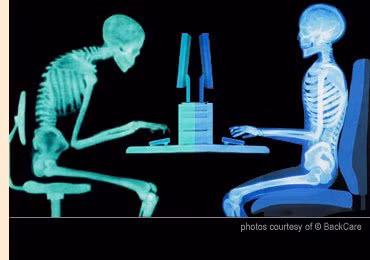  Thường xuyên ngồi không đúng tư thế khi làm việc bên máy vi tính. Đối với những người thường xuyên làm việc bên máy vi tính nhiều giờ liền thì đây là thói quen vô cùng nghiêm trọng. Nghiên cứu cho thấy rằng việc ngồi liên tục 8 giờ một ngày hoặc nhiều hơn có thể làm tăng nguy cơ bị bệnh cơ xương, tiểu đường, béo phì và các rối loạn khác. Bạn nên đặt màn hình máy tính dưới 5 – 7 cm so với tầm mắt của mình. Điều này giúp bạn duy trì tư thế ngồi thoải mái và tránh các nguy cơ gây hại khi bạn phải ngồi làm việc trong một thời gian dài.