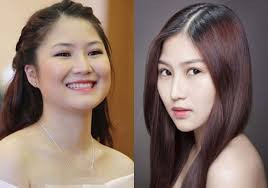 Mỹ nhân Việt và công cuộc 'đổi đời' nhờ 'dao kéo' - Ảnh 13 Mỹ nhân Việt và công cuộc 'đổi đời' nhờ 'dao kéo' - Ảnh 13