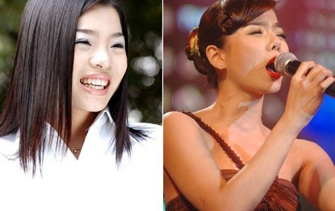 Mỹ nhân Việt và công cuộc 'đổi đời' nhờ 'dao kéo' - Ảnh 5 Mỹ nhân Việt và công cuộc 'đổi đời' nhờ 'dao kéo' - Ảnh 5