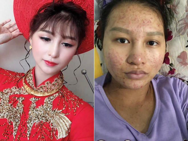 Nhan sac tan ta khi sinh no, co gai duoc chong chuyen tien den bu