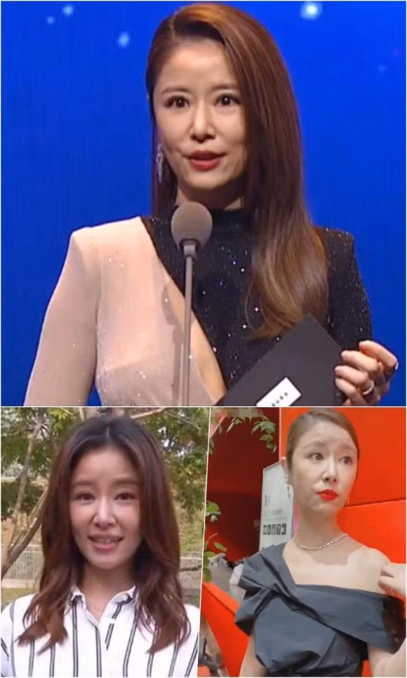 Lam Tam Nhu gay soc khi de mat moc lo nhieu nep nhan nhu ba lao-Hinh-5