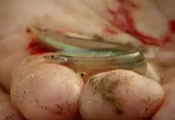 Ca sieu ac, thich chui vao vung kin co the nguoi-Hinh-5