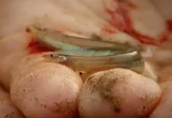 Ca sieu ac, thich chui vao vung kin co the nguoi-Hinh-5