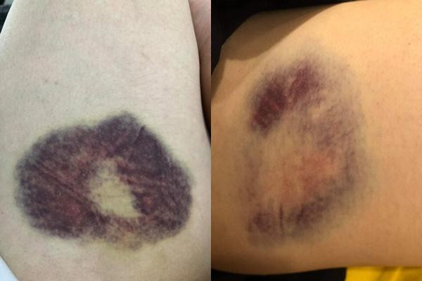 Chi vo to Gia Thi Linh tieu tam tung anh thuong tich day minh-Hinh-5