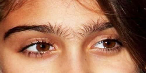 5 đặc điểm khuôn mặt của người nghèo khổ, tiêu tài tán lộc - Hình 2 5 dac diem khuon mat cua nguoi ngheo kho, tieu tai tan loc-Hinh-2