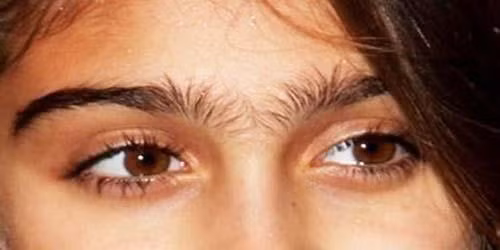 5 dac diem khuon mat cua nguoi ngheo kho, tieu tai tan loc-Hinh-2