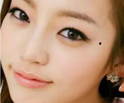 Phu nu co 5 not ruoi o nhung noi nay co so menh lan dan