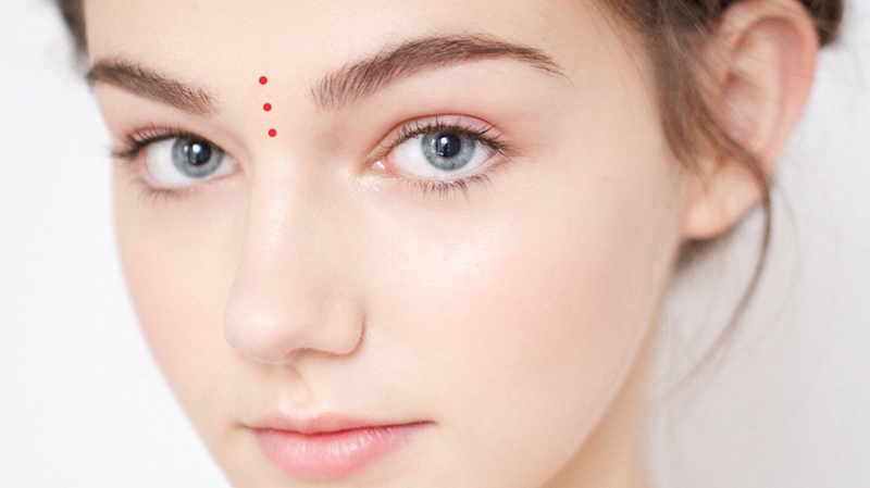 Not ruoi son bao truoc van do chot, di dau cung co quy nhan