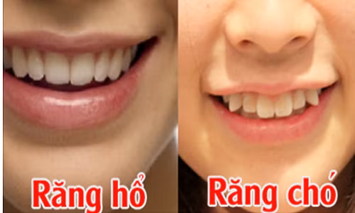 Nhin tuong rang biet tuong lai ban thanh ty phu hay ngheo nan-Hinh-2