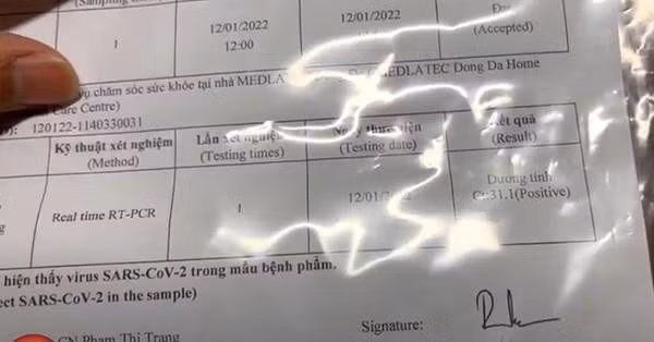 Quang Linh Vlogs nhan ket qua duong tinh trong ngay cach ly cuoi-Hinh-7