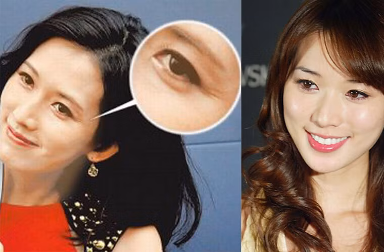 Siêu mẫu xứ Đài Lâm Chí Linh dù tốn rất nhiều tiền chăm sóc sắc đẹp nhưng vẫn bị lộ vết chân chim nơi khóe mắt mỗi khi cười.