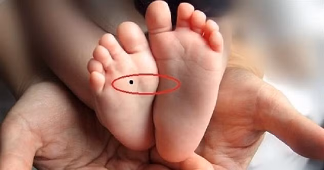  Nốt ruồi ở lòng bàn chân: Chu du thiên hạ. Người có nốt ruồi ở lòng bàn chân thường có nhiều yêu cầu trong công việc, hay phải đi công tác hoặc trong cuộc sống riêng cũng hay phải đi lại.