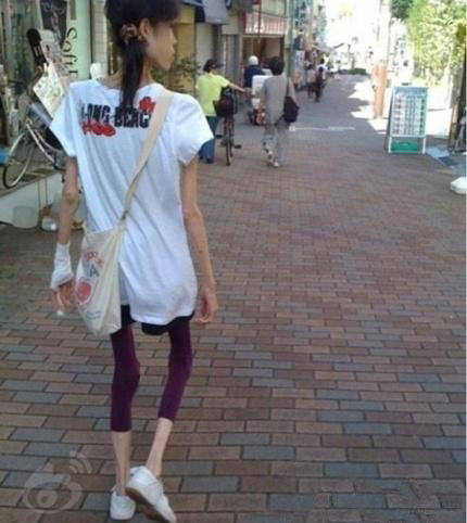 Cô gái gầy guộc.