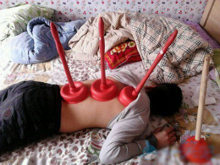 "Ống giác hơi" đa di năng.