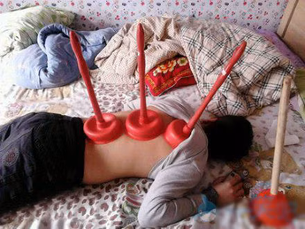 "Ống giác hơi" đa di năng.