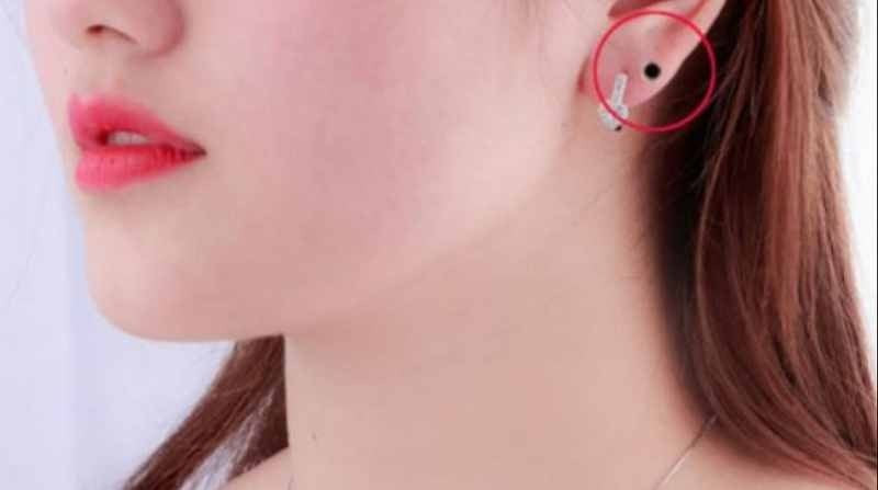 Những người có nốt ruồi trên dái tai nhìn chung là người có sức khỏe tốt, sống lâu hơn. Bạn có thể vừa tức giận vừa sống một cuộc sống sung túc.