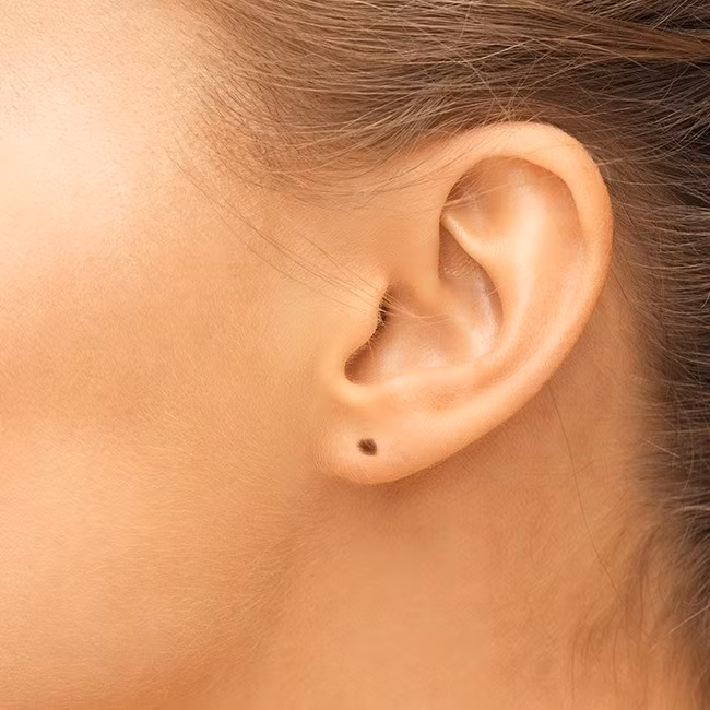 Nếu nốt ruồi xuất hiện ở dái tai này thì có nghĩa vận may tài chính của người đó rất xuất sắc, nhưng những người như vậy nhìn chung không có tư chất, khả năng quản lý tiền bạc dễ dàng.