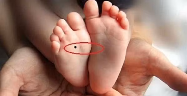 3 dau hieu o ban chan tiet lo ban phuc lon