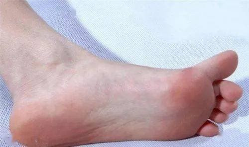 Phu nu song tho hay khong, nhin 'ban chan' la biet?-Hinh-2