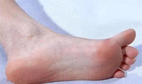 Phu nu song tho hay khong, nhin 'ban chan' la biet?-Hinh-2