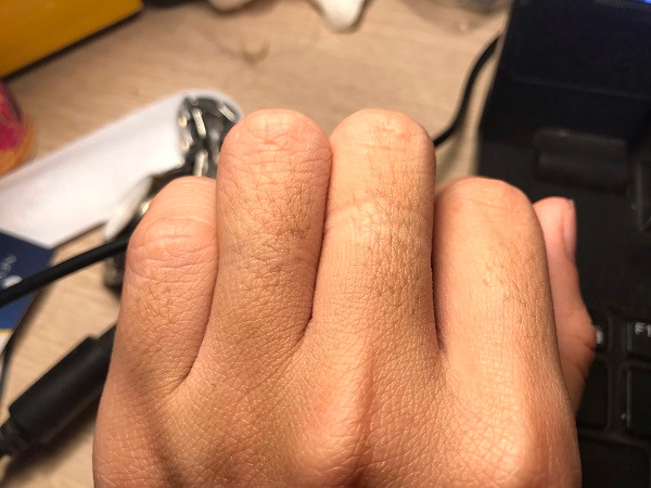  2. Lông dày ở mu ngón tay. Nếu lông ở mu ngón tay của phụ nữ mọc dày, xét từ góc độ nhân tướng học thì nó tượng trưng cho sự thịnh vượng và tài lộc.