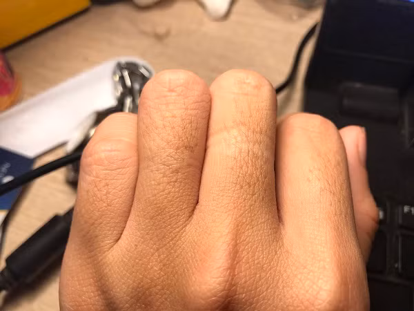  2. Lông dày ở mu ngón tay. Nếu lông ở mu ngón tay của phụ nữ mọc dày, xét từ góc độ nhân tướng học thì nó tượng trưng cho sự thịnh vượng và tài lộc.