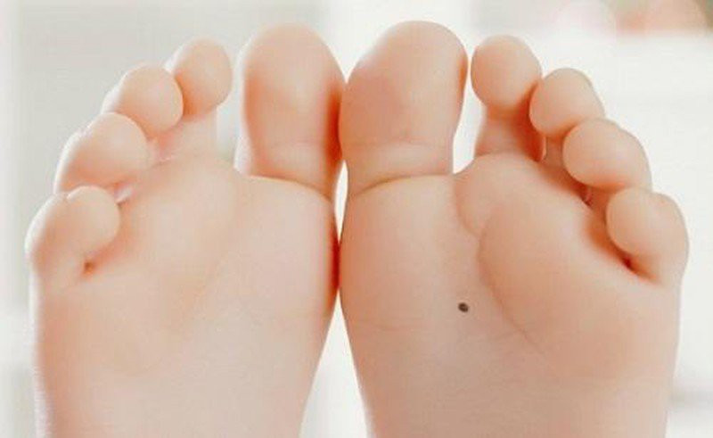 Từ vẻ ngoài cho đến tư chất bên trong, những đứa trẻ có nốt ruồi ở lòng bàn chân trái đều thể hiện mình là nhân trung long phượng, mang lại nhiều niềm vui và hạnh phúc cho cha mẹ.