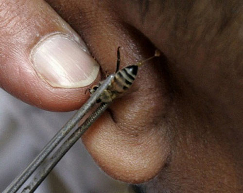 Thậm chí để dụ dỗ người dân với lời mời mọc "nọc ong có thể chữa được nhiều bệnh nan y mà y học từng bó tay" và không ngừng rêu rao rằng: "Dùng nọc ong có thể chữa được hơn 30 loại bệnh".