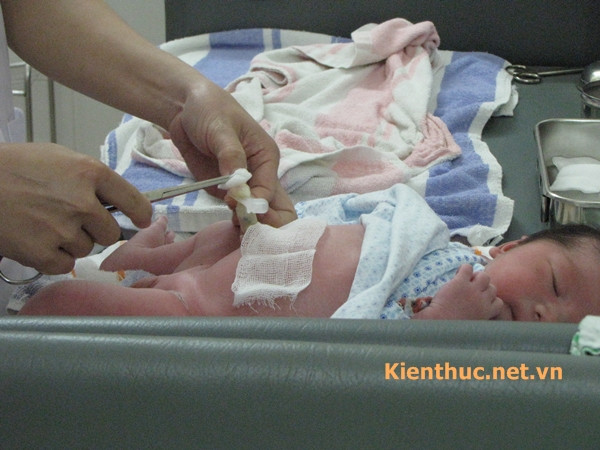 Thao tác làm rốn, chấm rối cho em bé