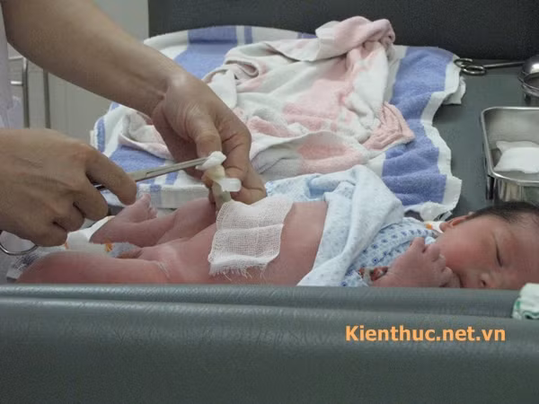 Thao tác làm rốn, chấm rối cho em bé