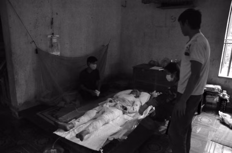 Tình trạng này rất nguy hiểm với công nhân khai thác than. Vừa qua vụ nổ khí than ở đây các nạn nhân không cứu được chủ yếu là do bị bỏng ở những nơi không được bảo hộ (bỏng nặng 70-85%). Trong ảnh: Nạn nhân Bùi Văn Chỉnh (27 tuổi), xóm Thông, xã Cuối Hạ bị bỏng đến 90%, sau hơn 10 ngày điều trị do không có tiền chữa trị tại bệnh viện nên được đưa về nhà, đến nay anh đã không qua được cơn nguy kịch.