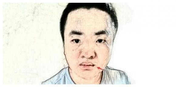 br/> 5. Người miệng cá chép có tính hay phàn nàn: Miệng cá chép chủ yếu dùng để chỉ khóe miệng của một người rủ xuống, trông giống như một cái miệng sắc nhọn! Miệng tượng trưng cho thái độ của một người. Nếu một người có khóe miệng trễ xuống thì người này nhìn chung là người sống nội tâm và không thích thể hiện, nhưng lại rất hay nghi ngờ và không dễ dàng tin tưởng người khác. 