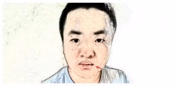 br/> 5. Người miệng cá chép có tính hay phàn nàn: Miệng cá chép chủ yếu dùng để chỉ khóe miệng của một người rủ xuống, trông giống như một cái miệng sắc nhọn! Miệng tượng trưng cho thái độ của một người. Nếu một người có khóe miệng trễ xuống thì người này nhìn chung là người sống nội tâm và không thích thể hiện, nhưng lại rất hay nghi ngờ và không dễ dàng tin tưởng người khác. 