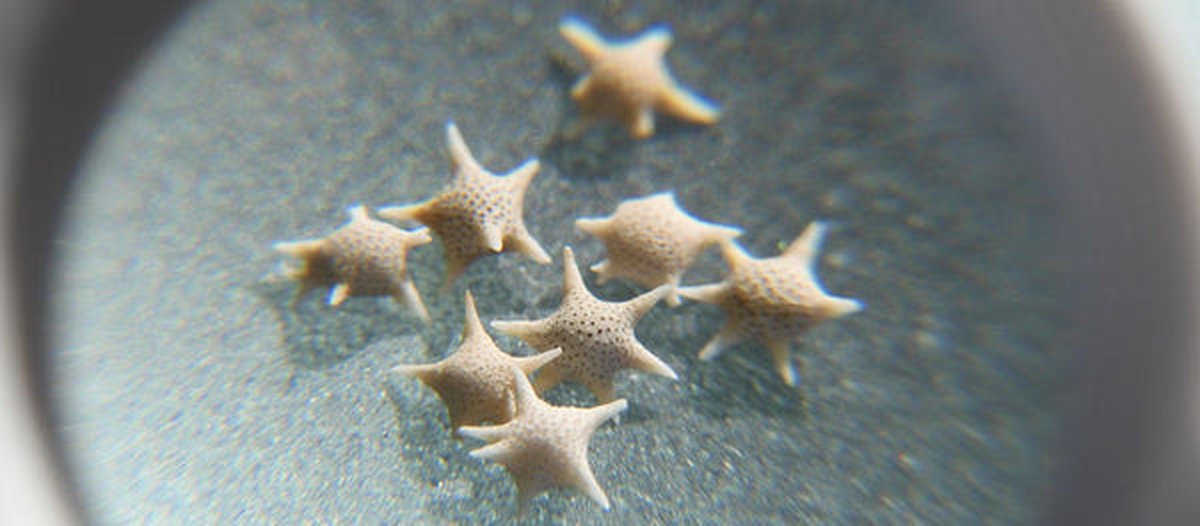 Vì vậy, lớp vỏ giống như quần thể của Trùng lỗ và tất cả tế bào này. Cơ thể hình ngôi sao của Trùng lỗ có nhiều sợi nhỏ giúp dẫn ánh sáng tới tảo cát để tạo ra thức ăn.