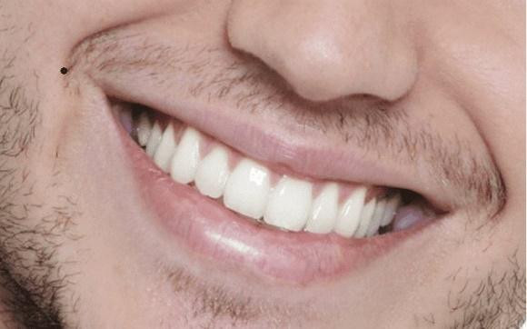 Dan ong so huu nhung not ruoi nay trang hoa da tinh-Hinh-2